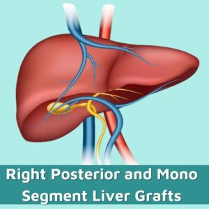Laparoscopic and Robotic Liver Transplant (2)