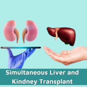 Laparoscopic and Robotic Liver Transplant